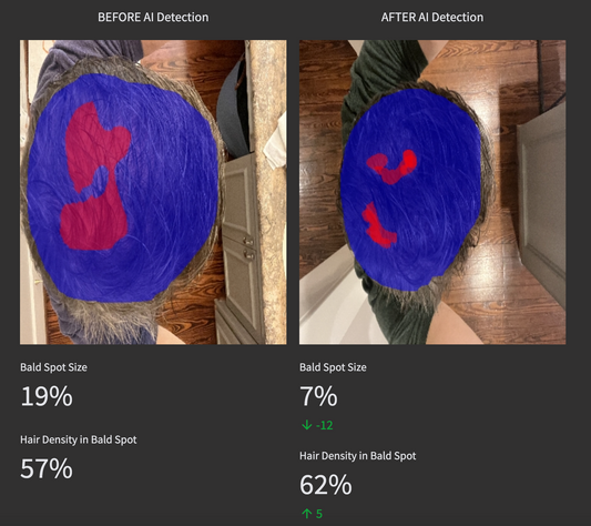 Check YOUR bald spot with AI.
